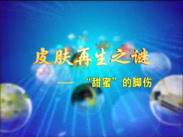 皮肤再生之谜--"甜美" 的脚伤